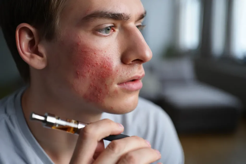 Quels sont les effets de la cigarette électronique sur votre peau ?